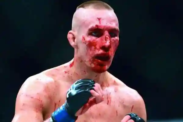TOP 10 Сломанных носов в истории MMA