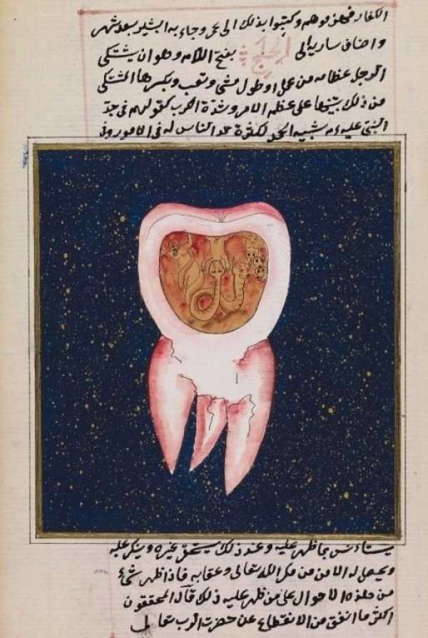 Как в Средневековье люди справлялись с гигиеной полости рта?