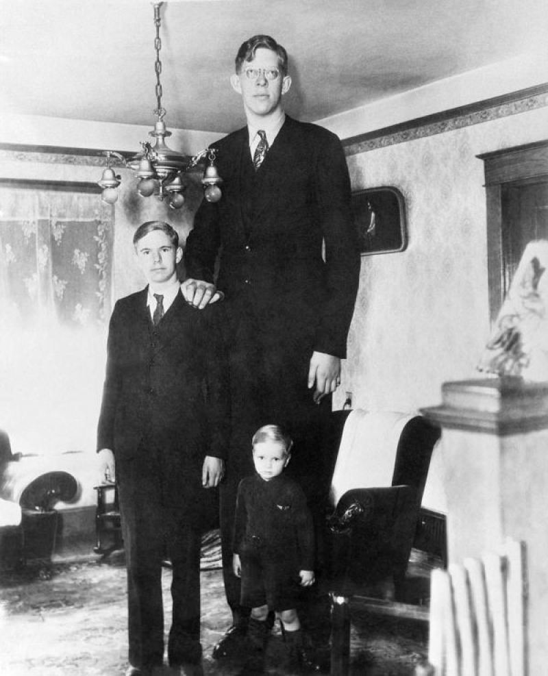 Роберт Уодлоу - самый высокий человек 