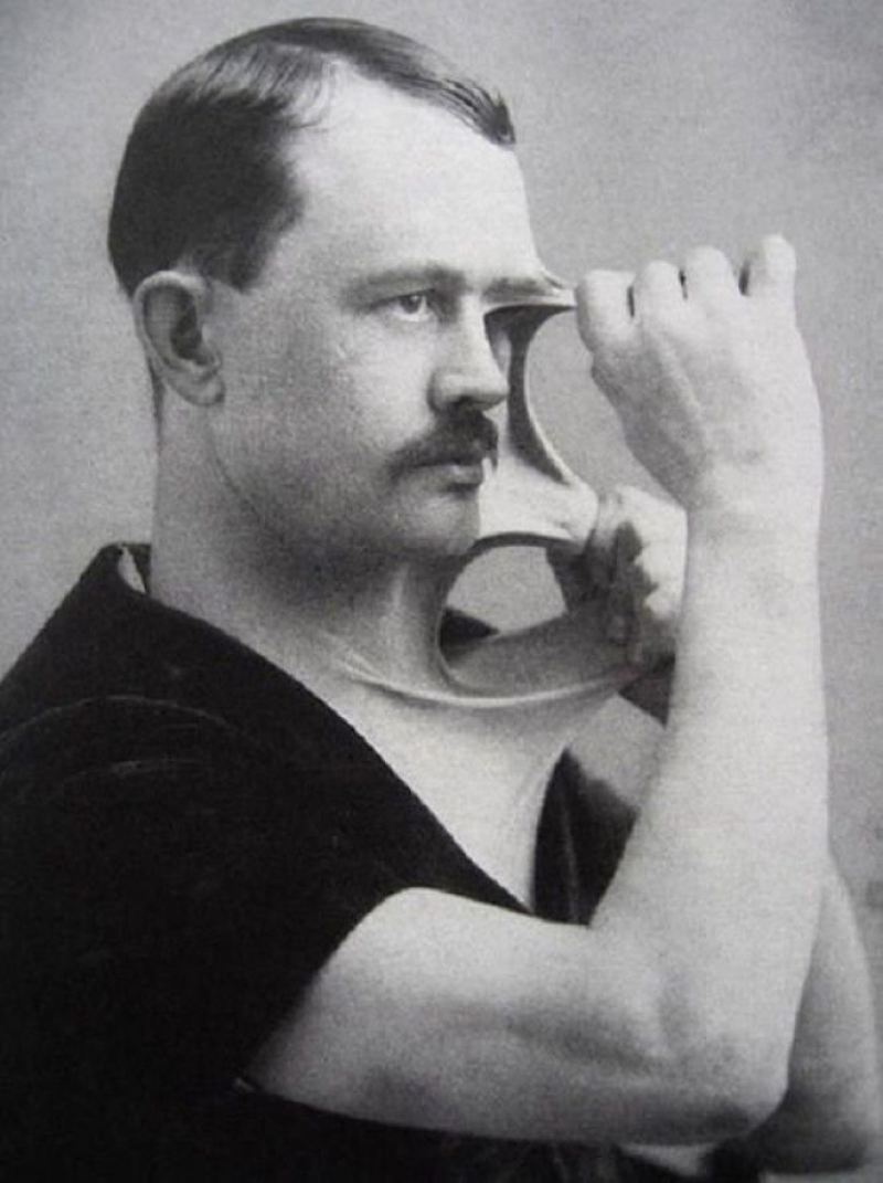 Мужчина с невероятно эластичной кожей, 1900-е. история, факты, фото.