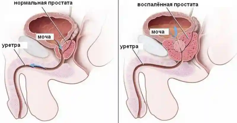 Брюнетка с простатитом. Фельдшер — о том, чем болеют трансгендеры