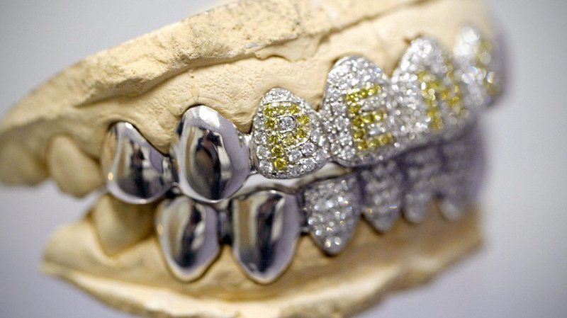 Как рвали зубы в раньше: искусство и стоматология