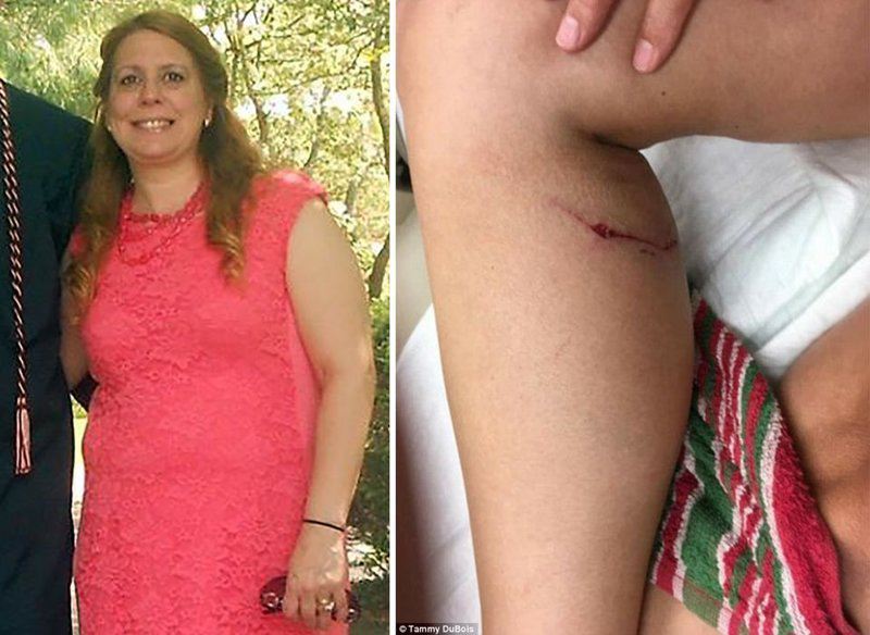 52-летняя американка задушила бешеную лисицу одной рукой