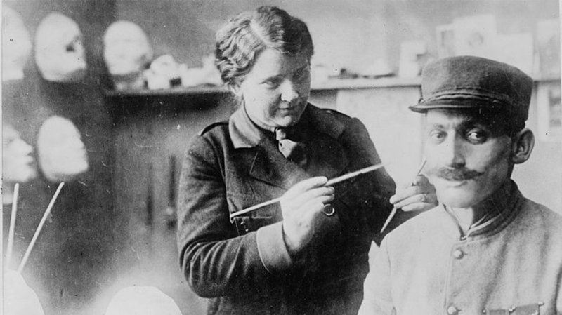 Пластическая хирургия Первой мировой: как хирурги восстанавливали