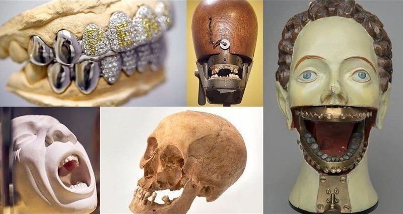 Как рвали зубы раньше: искусство и стоматология