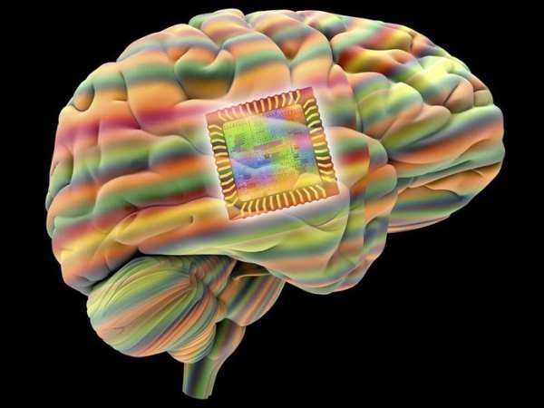 Человеку впервые улучшили память мозговым имплантом